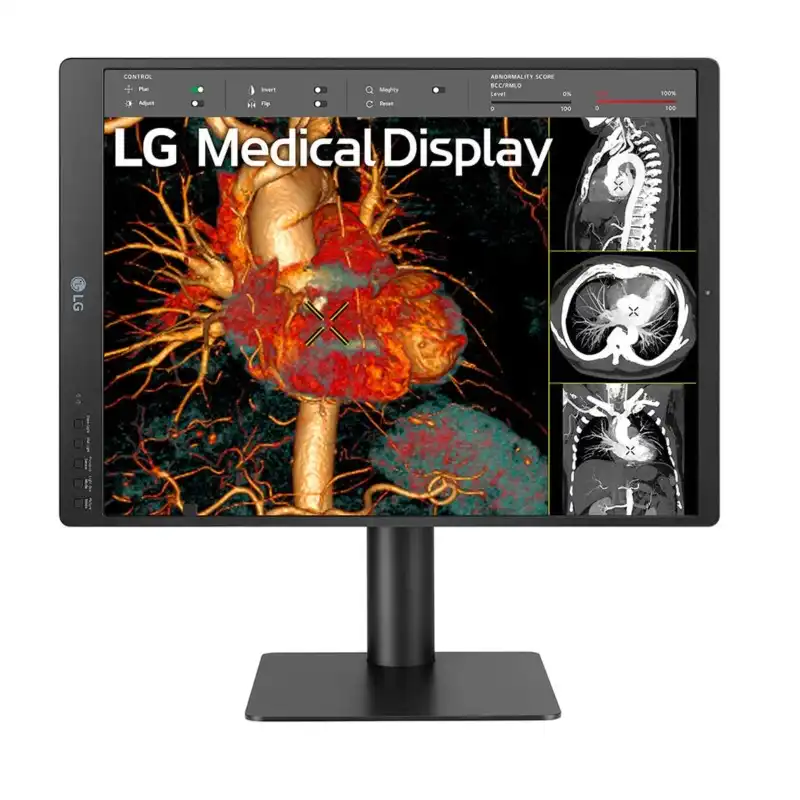Monitor de Diagnostico LG 21HQ513D-B 21.3PLG