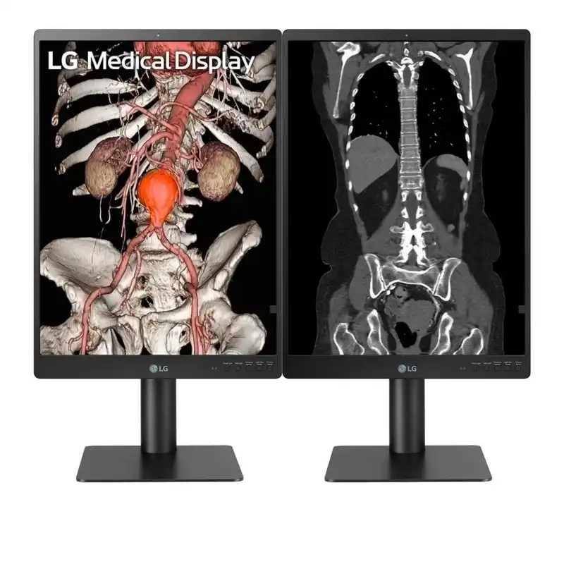 Monitor de Diagnostico LG 21HQ513D-B 21.3PLG